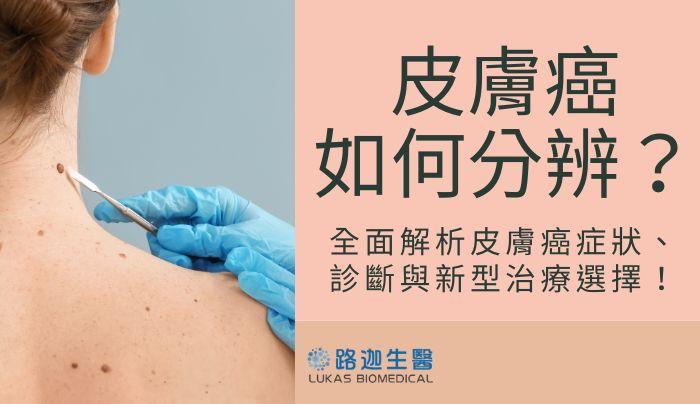 皮膚癌如何分辨?全面解析皮膚癌症狀、診斷與新型治療選擇!